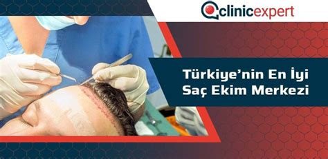 Türkiye''de en iyi saç ekim merkezi